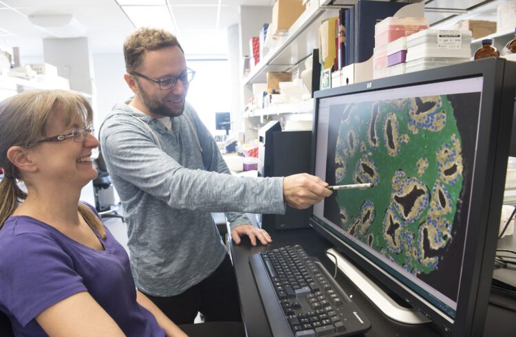 Francis Rodier et Nicolas Malaquin font une découverte qui permet de cibler des cancers liés à l’inflammation