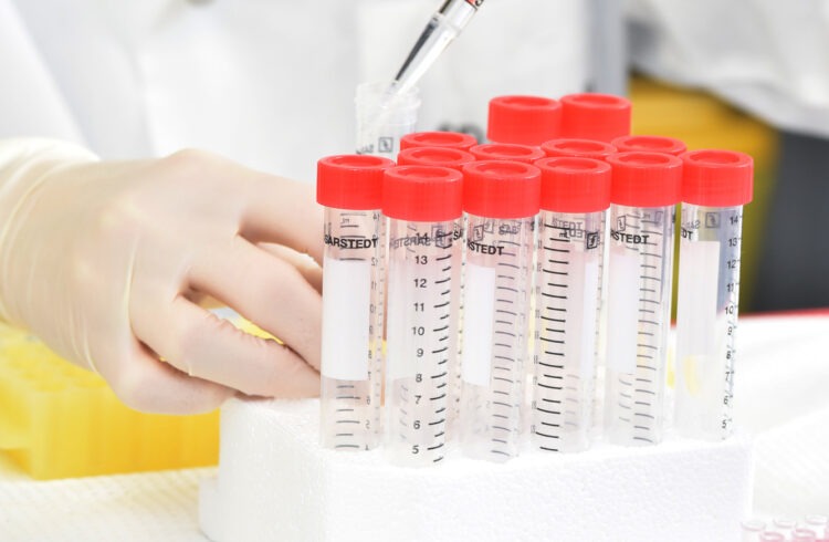 The Montreal cancer Institute funded part of the research leading to a promising discovery