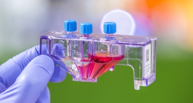 Dr. Simon Turcotte’s team won two grants totaling more than $ 2M for a first clinical study in cell therapy